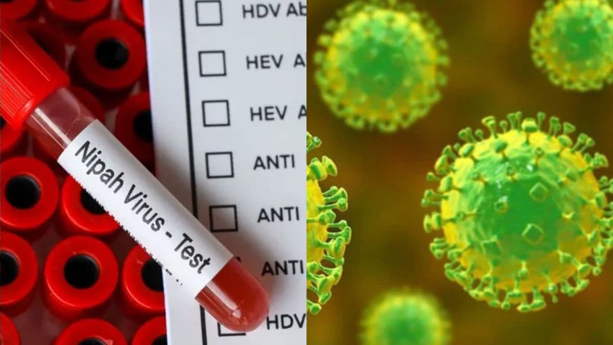 nipah virus.jpg