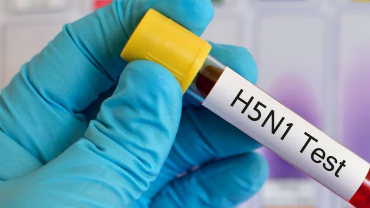 H5N1.jpeg