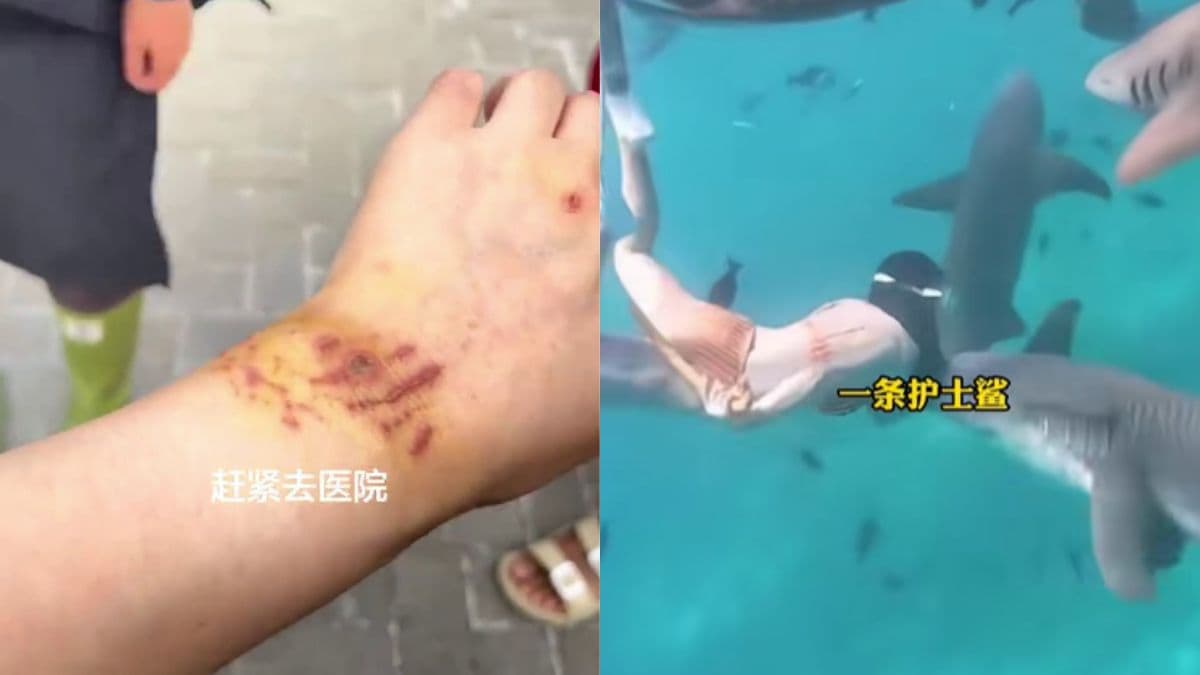 china woman shark bite.jpg