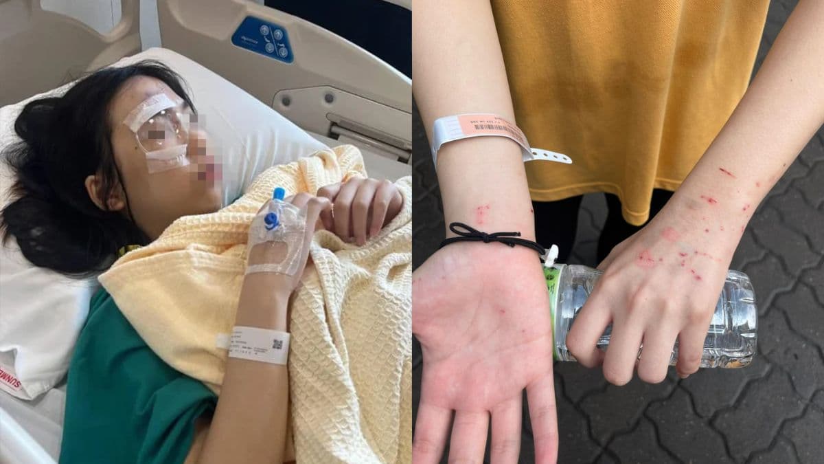 daughter was injured in a science lab explosion.jpg